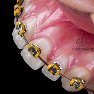 Curso de Imersão em Fotografia Odontológica Profissional